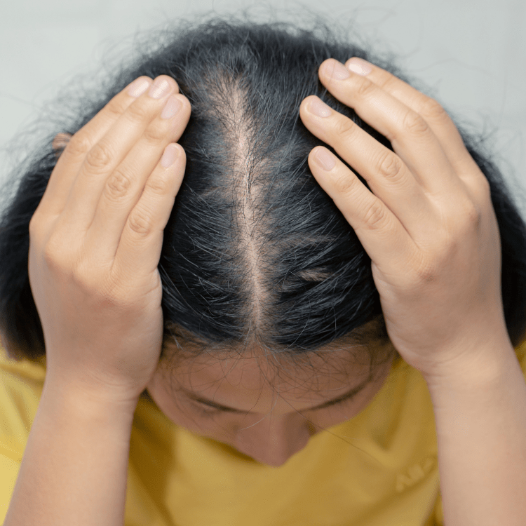 Hair Fall